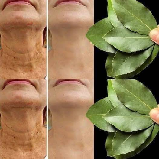 Bay Leaf for Skin Care: Debunking Myths and Exploring Natural Recipes